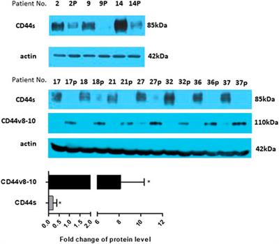 Overexpression of CD44v8-10 in Colon Polyps—A Possible Key to Early Diagnosis